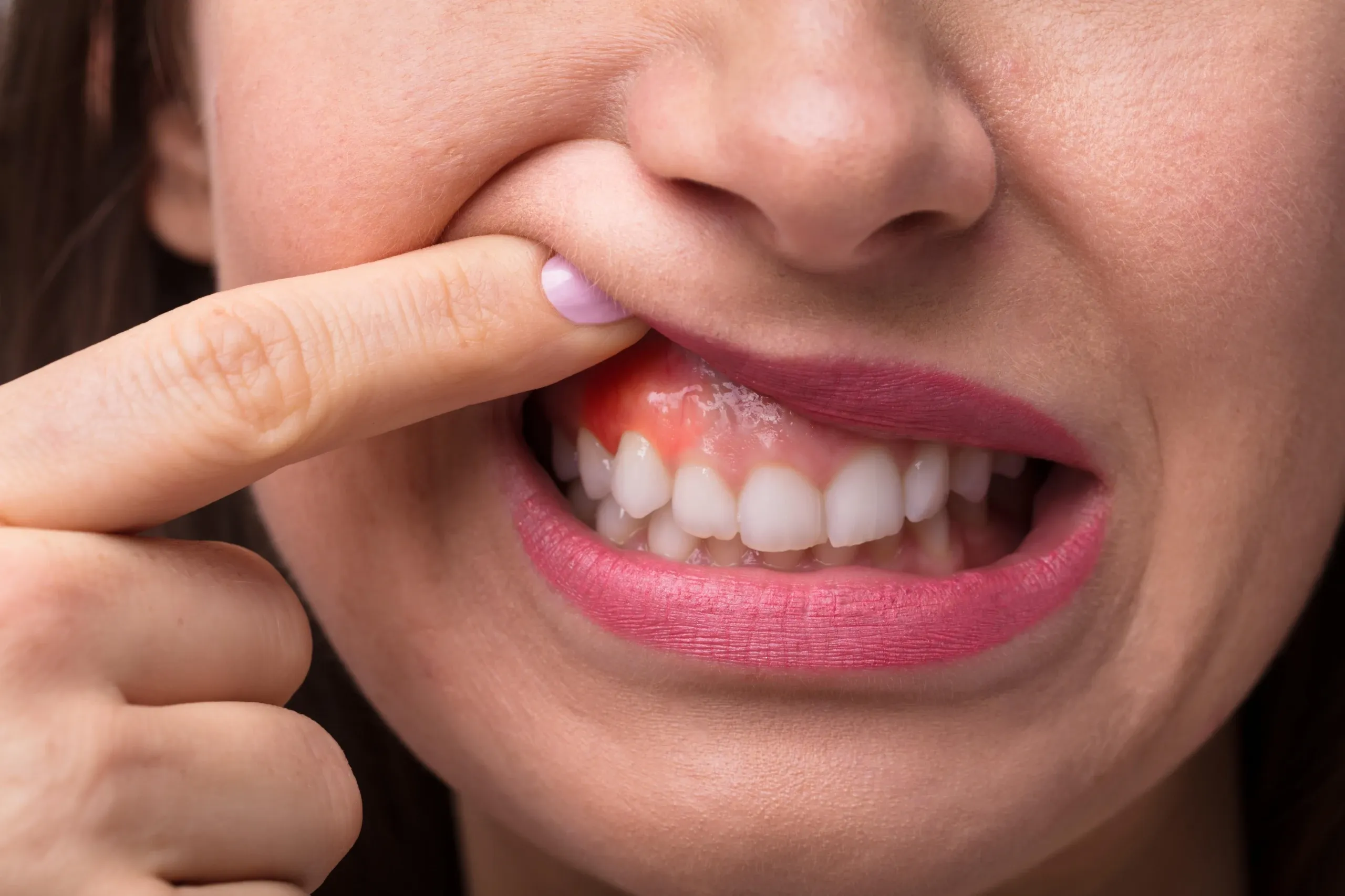Patient discussing sensitive teeth with Dr. Shachi Shah at Enclave Dental in Lake Mary FL