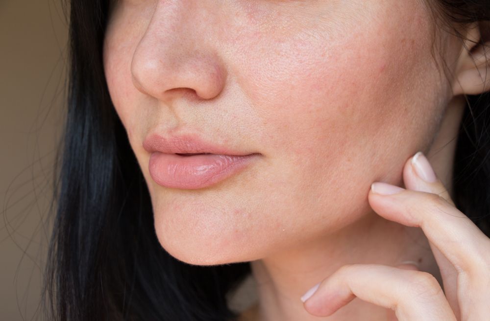 What Causes Facial Hair Growth in Women?