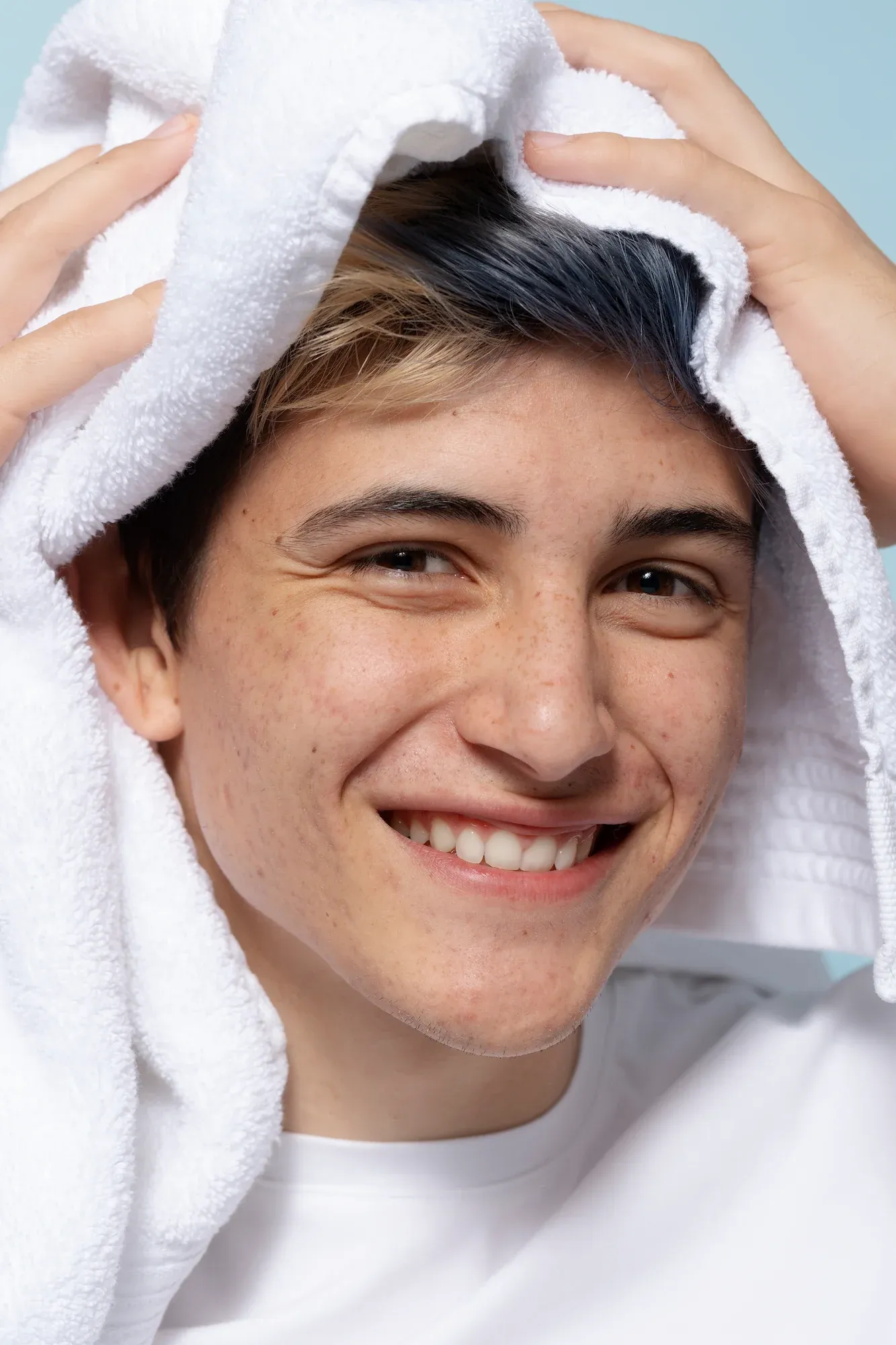 Close-up visual of acne and scarring concerns at Mint Aesthetics & Skin