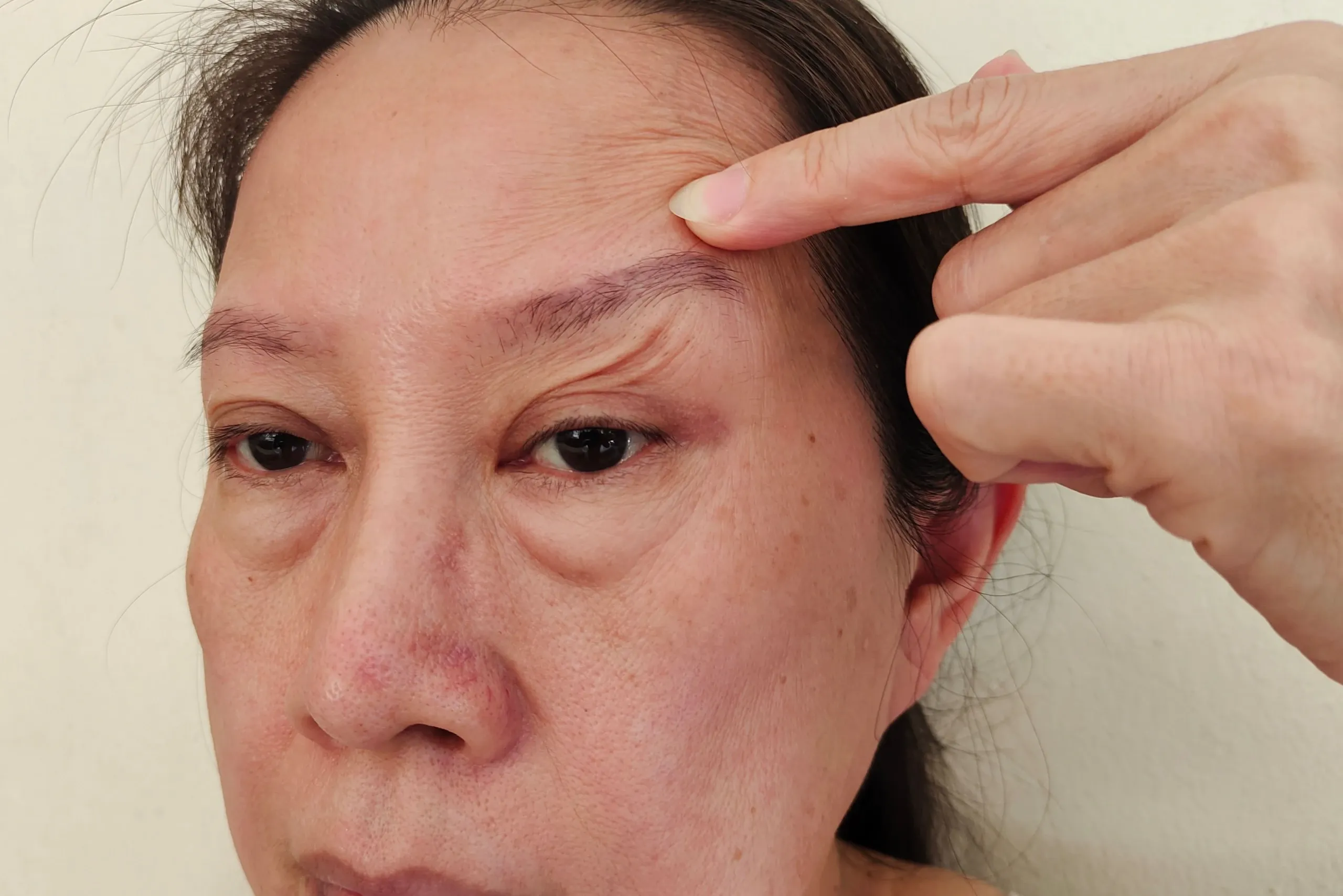 Diagram showing elastin and collagen fiber structure at Eternal Wellness Medical Spa