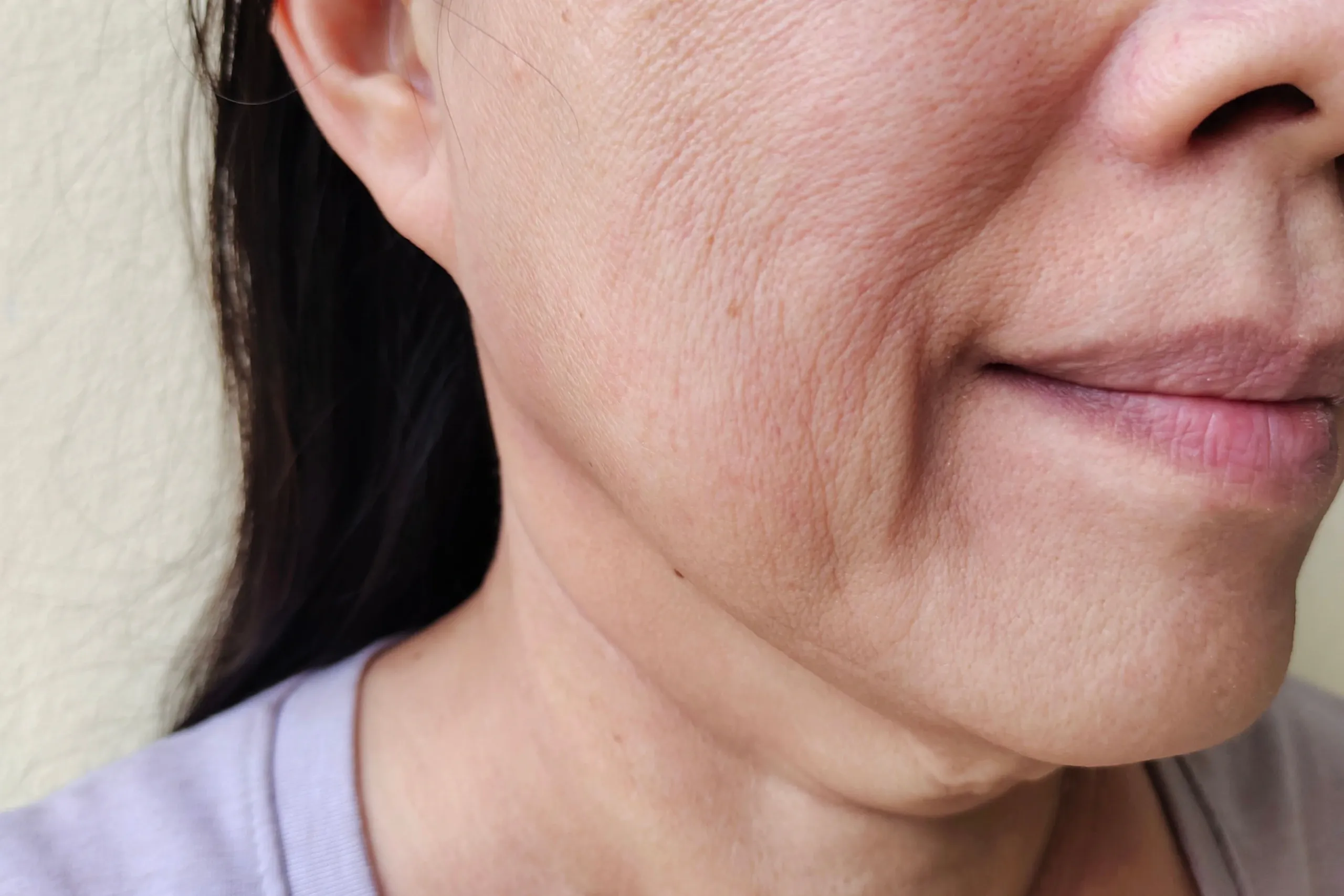 Lifestyle factors affecting skin firmness at Eternal Wellness Medical Spa Traverse City