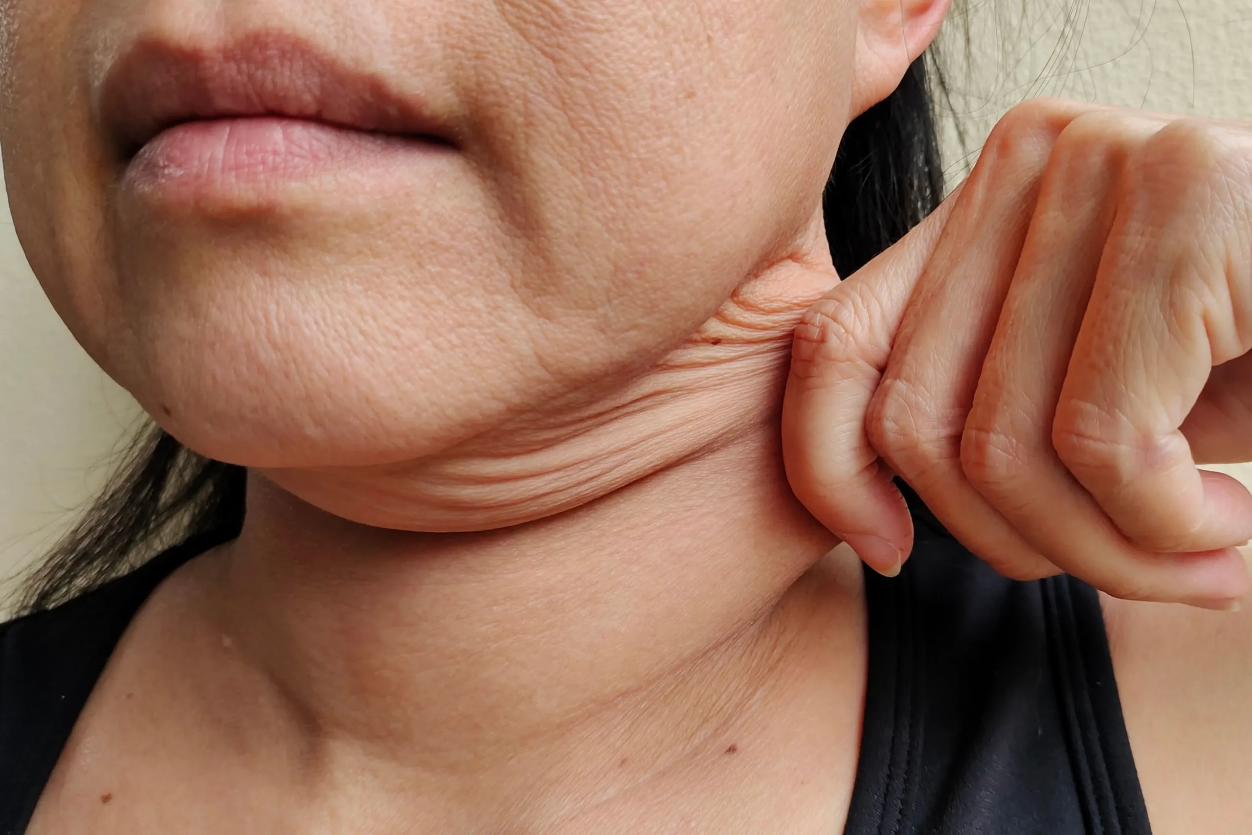 Woman addressing skin laxity concerns at Eternal Wellness Medical Spa Traverse City