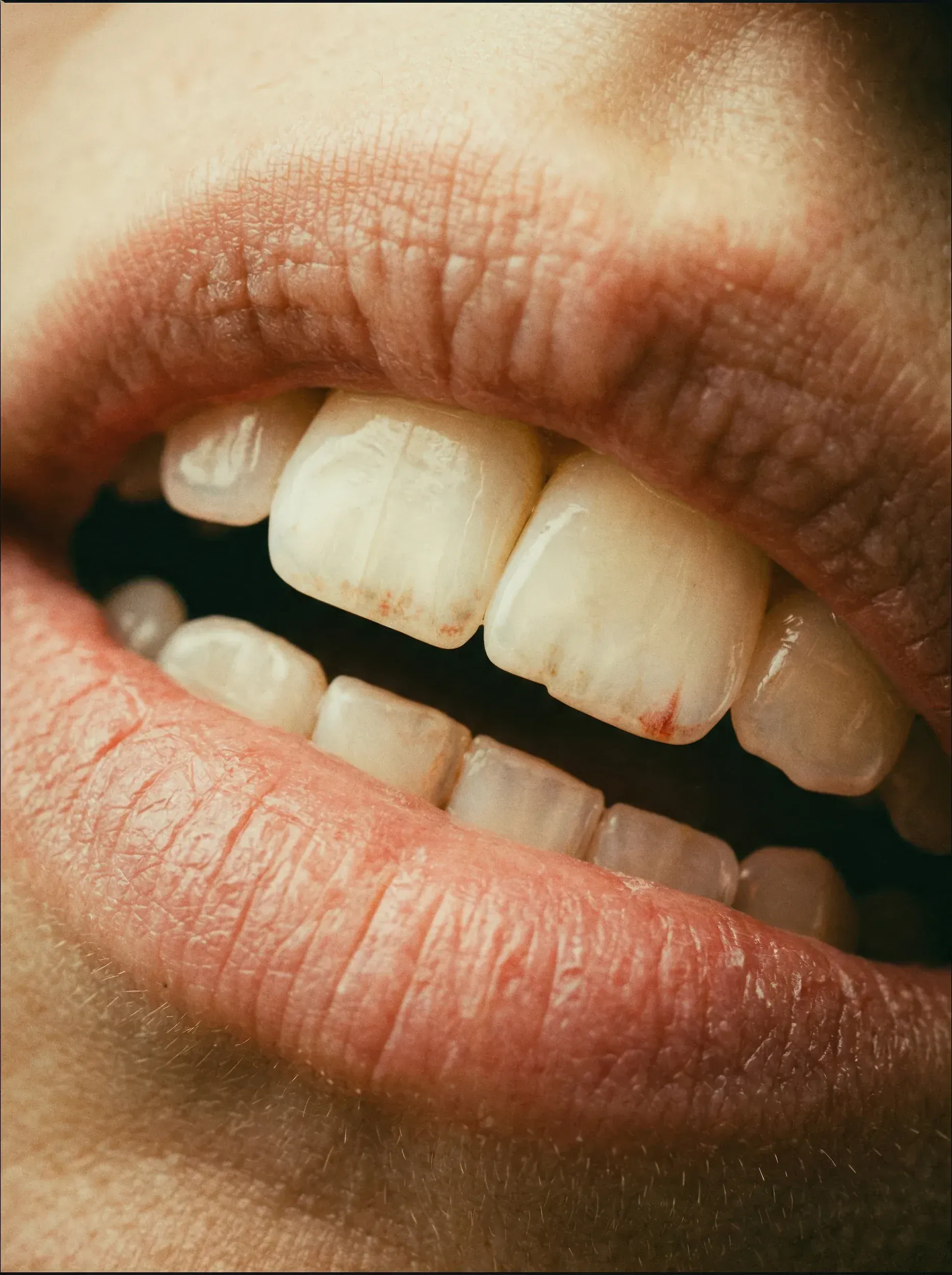 Coffee, red wine, and tea on a table, common causes of stained teeth