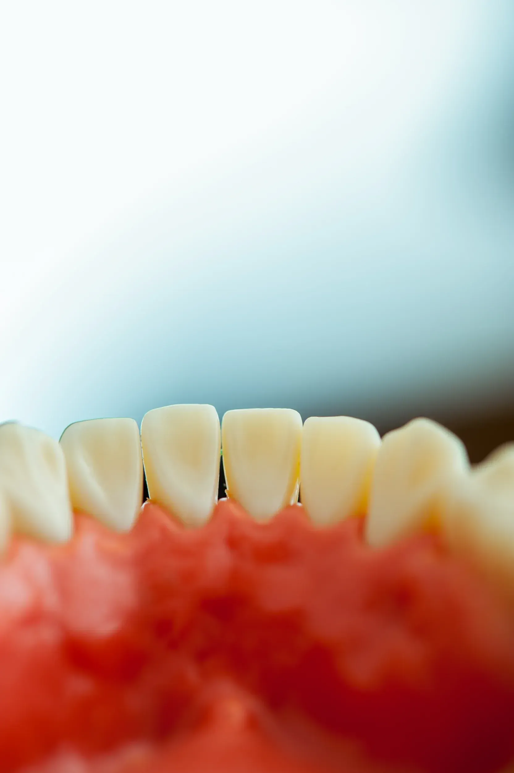 Side-by-side examples of different tooth stain patterns including yellow, white spots, and dark bands