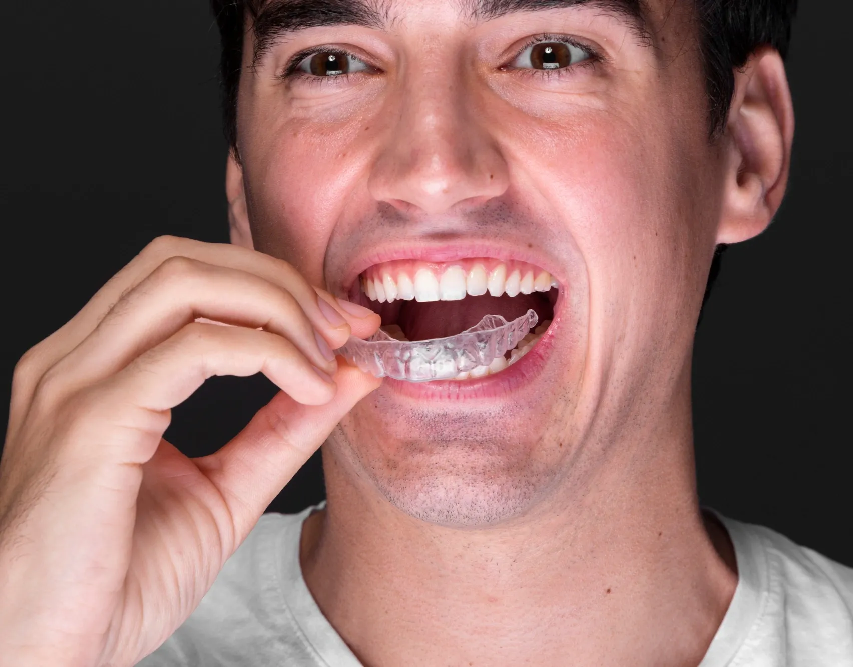 Close-up of worn teeth caused by bruxism