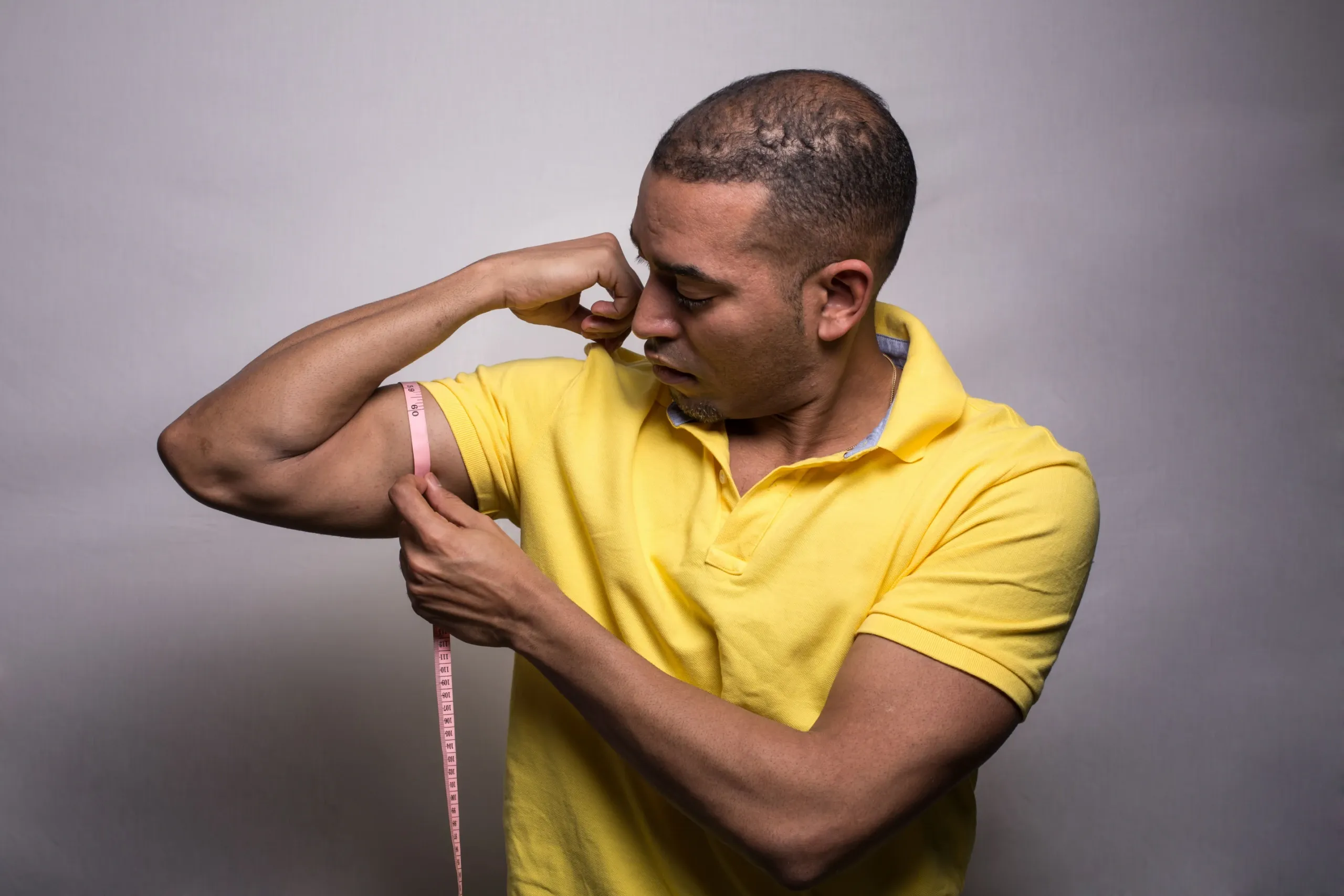 Does Testosterone Cause Hair Loss?