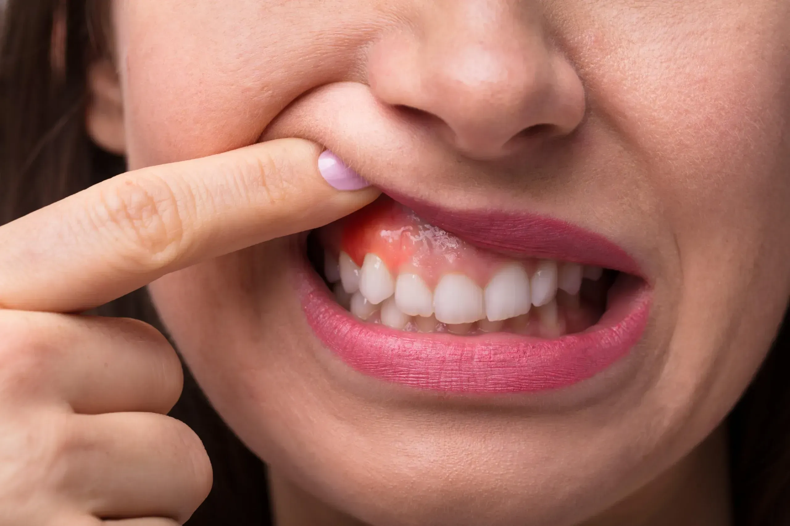 <span class="text-accent">Tooth Sensitivity</span> in Santa Rosa Beach, FL
