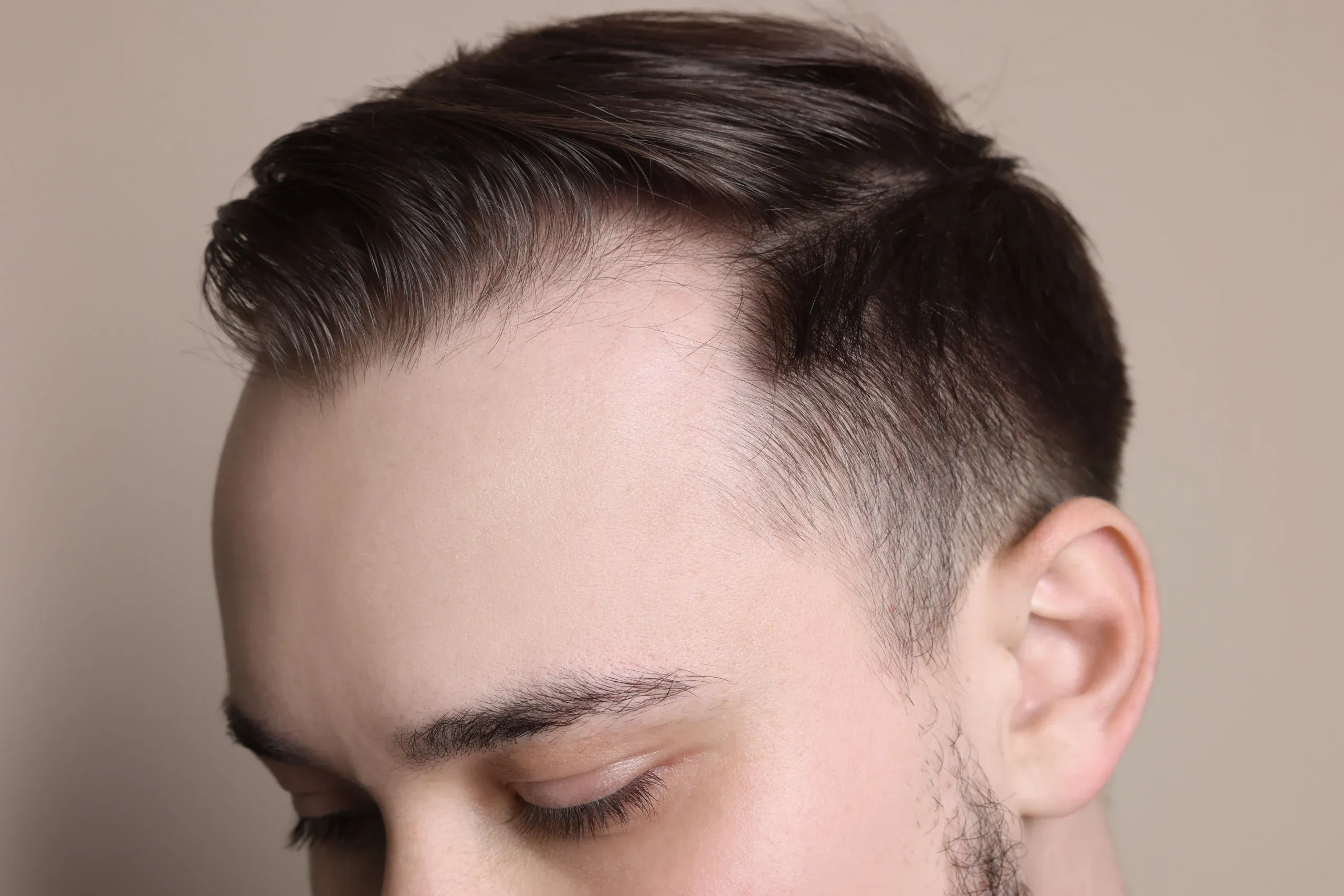 Uneven Hairline: What It Means and What You Can Do