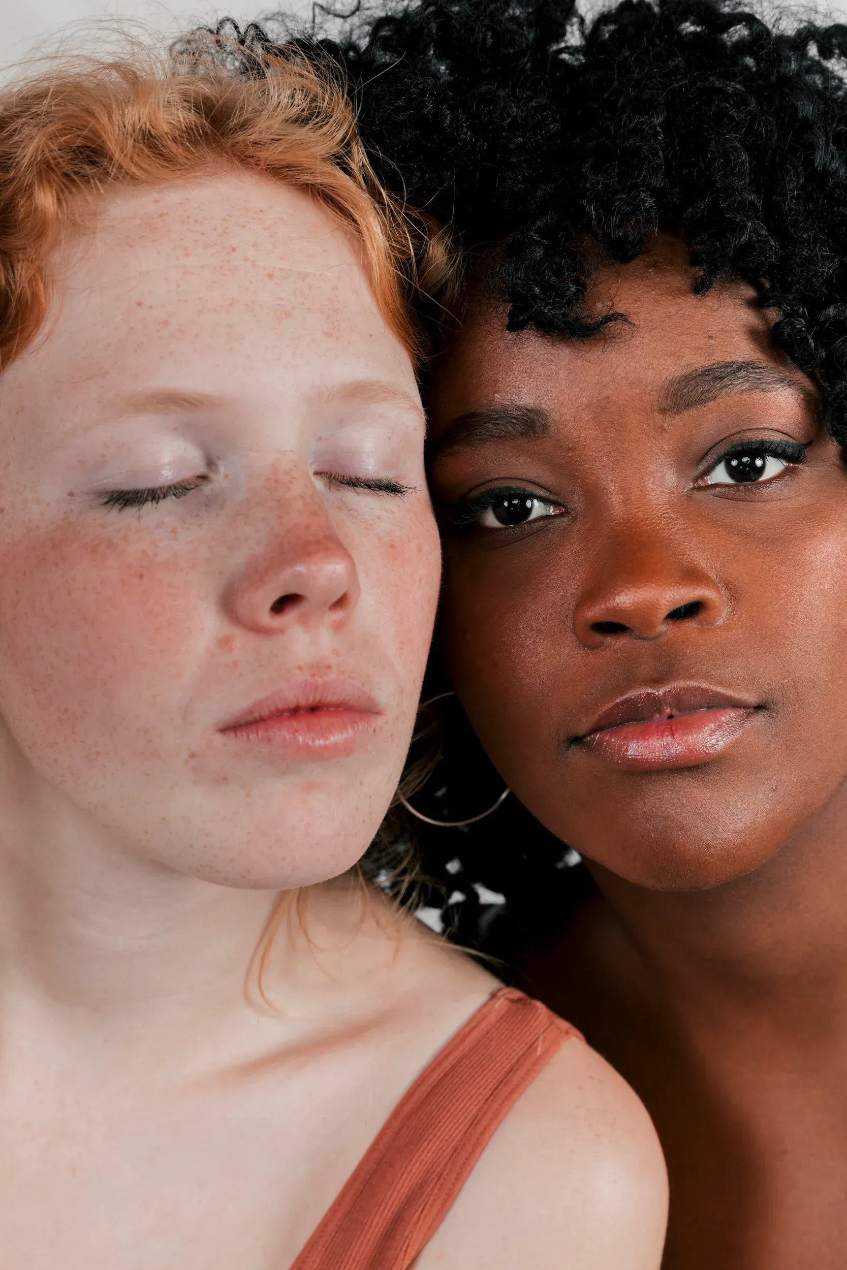 Close-up of uneven skin texture including enlarged pores and acne scarring at Dental World Longwood