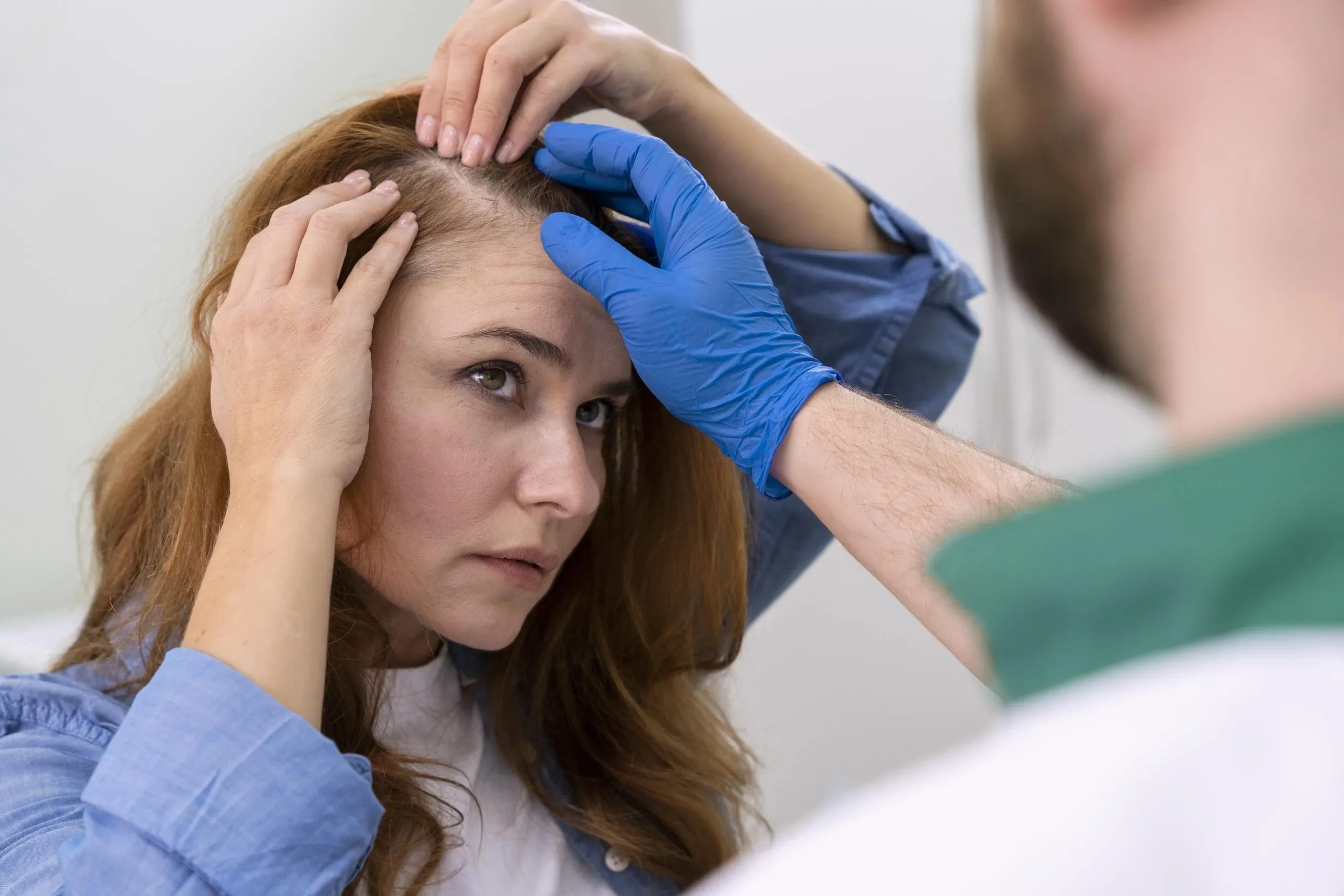 Hair Transplant for Women: Can Women Get Hair Transplants?