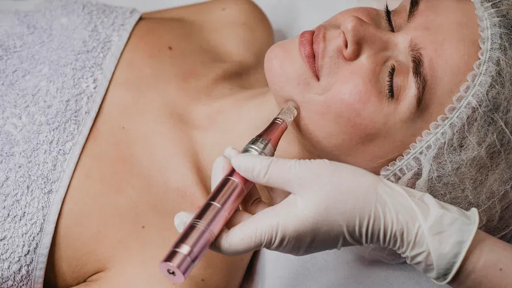 Microneedling Before and After: What to Expect After 1, 3, and 6 Treatments