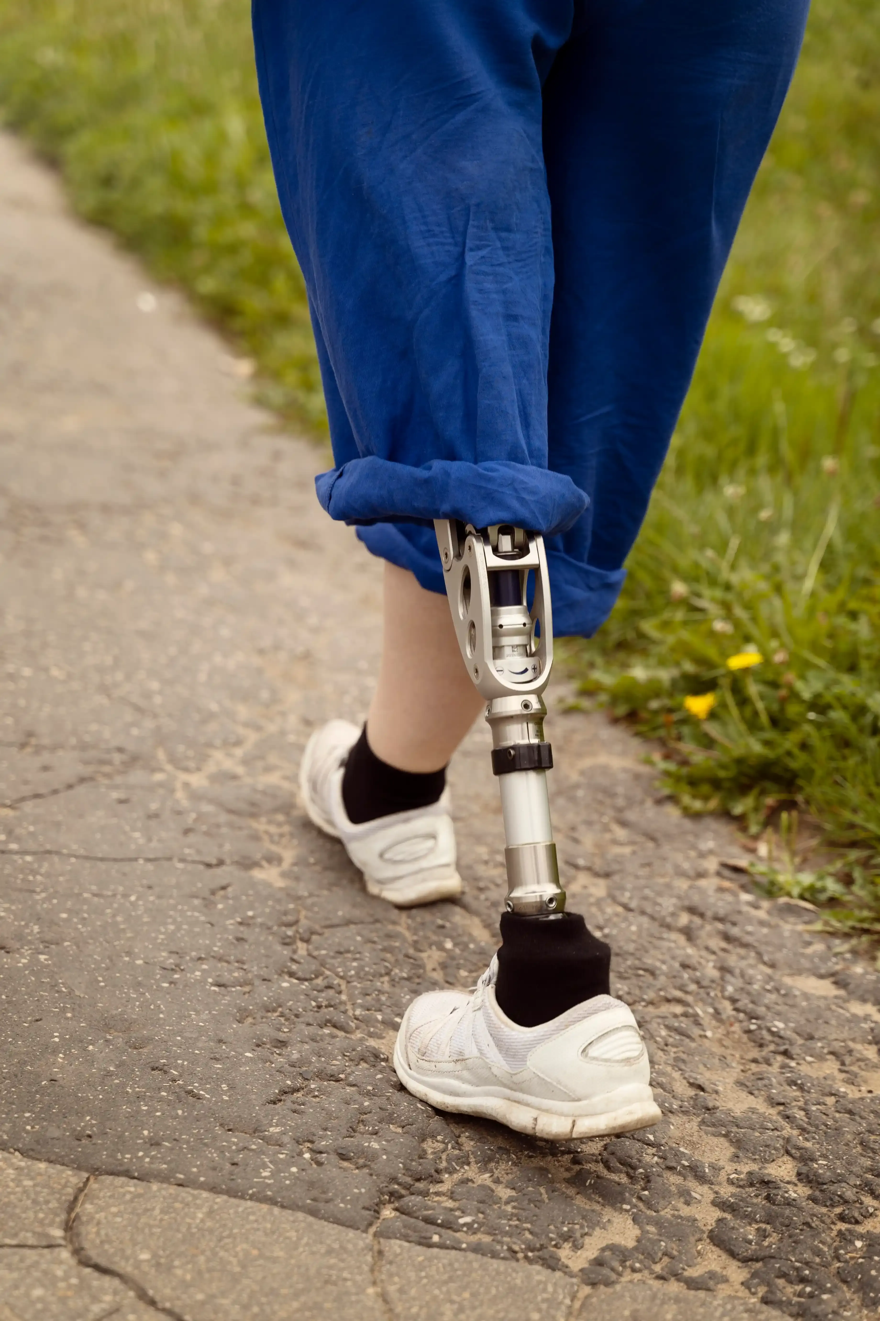Educational overview of phantom limb pain at Physicians Ketamine Institute Destin