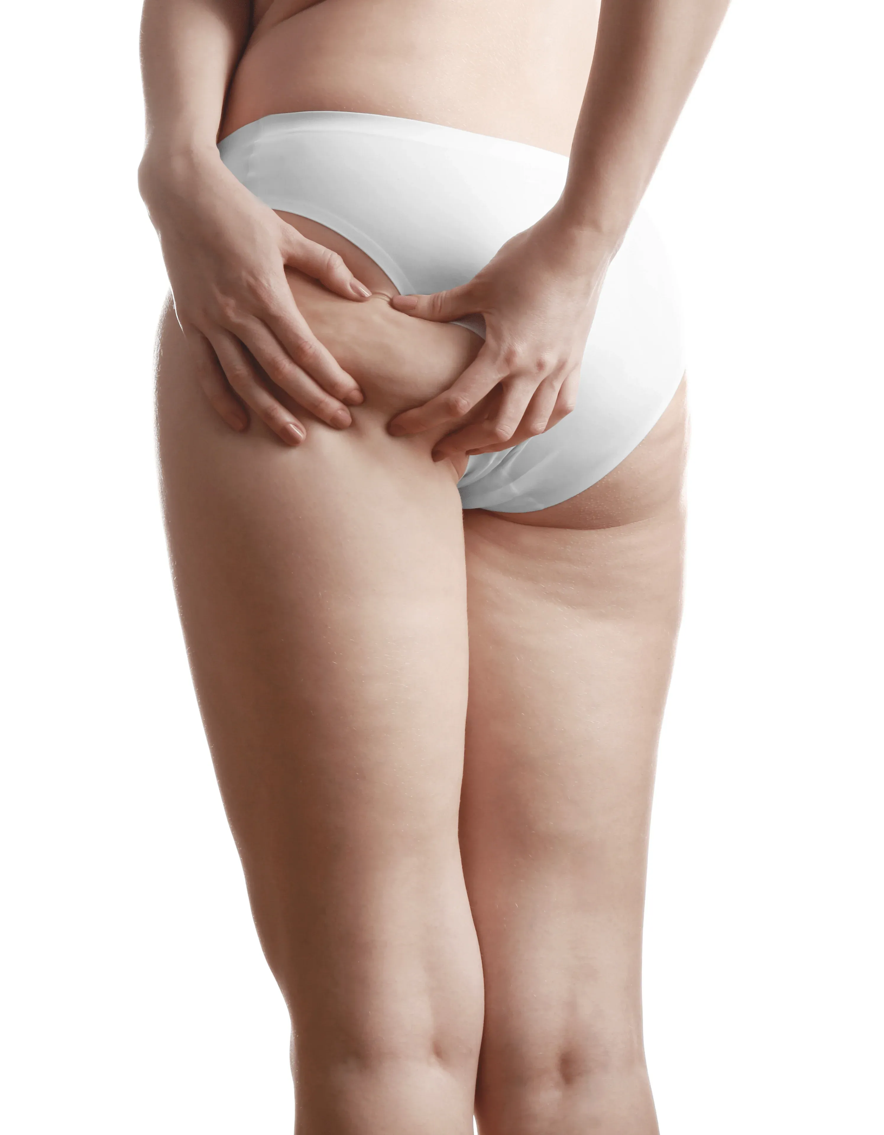 Woman concerned about cellulite at Arise Integrative Wellness