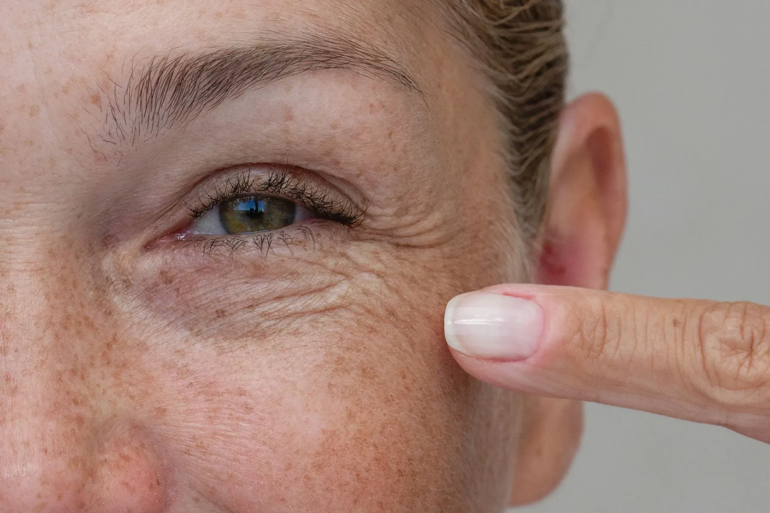 Person examining wrinkles in mirror at Resurgent Health Fargo