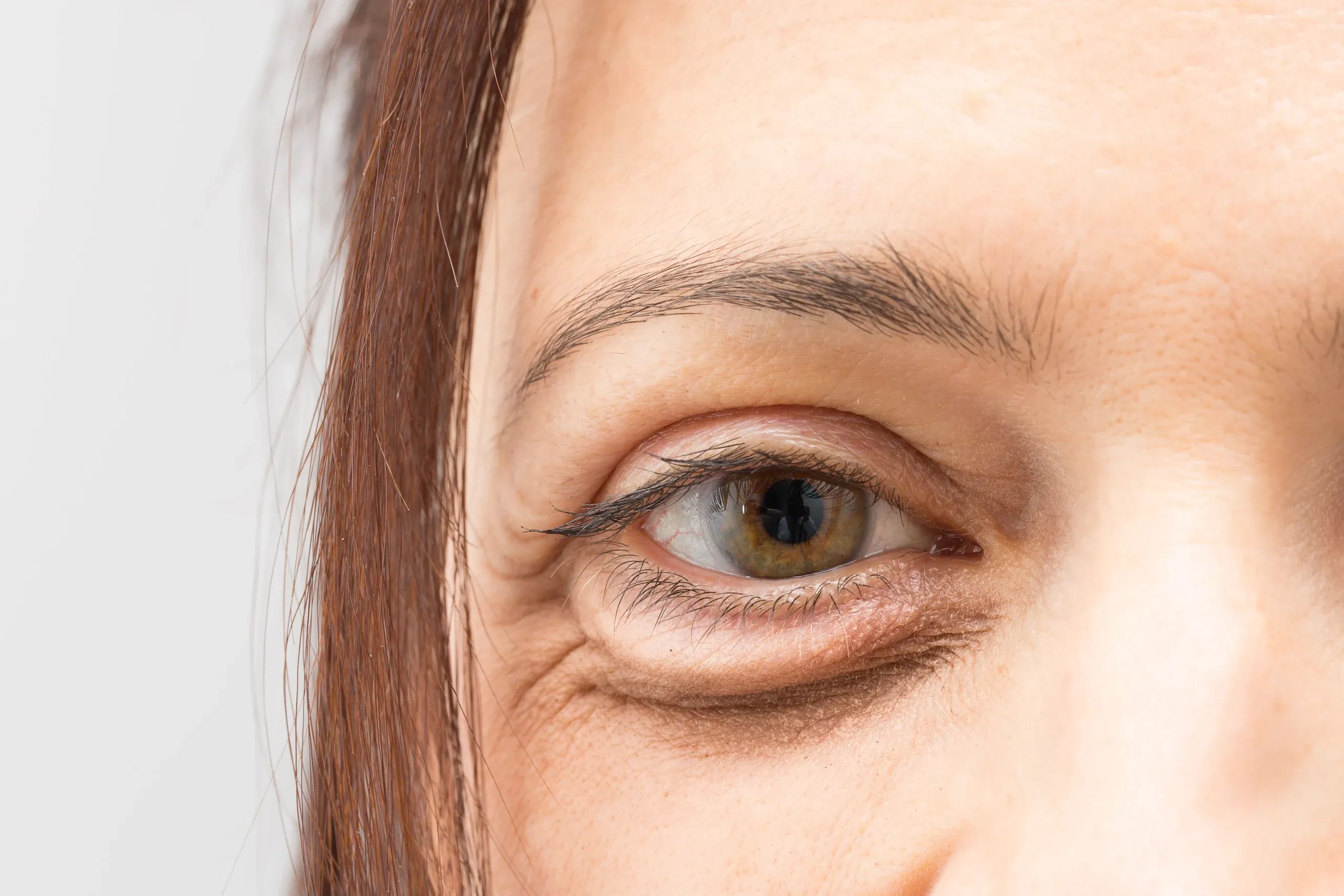 Illustration of collagen loss and wrinkle formation at Hartley Health and Wellness Canton