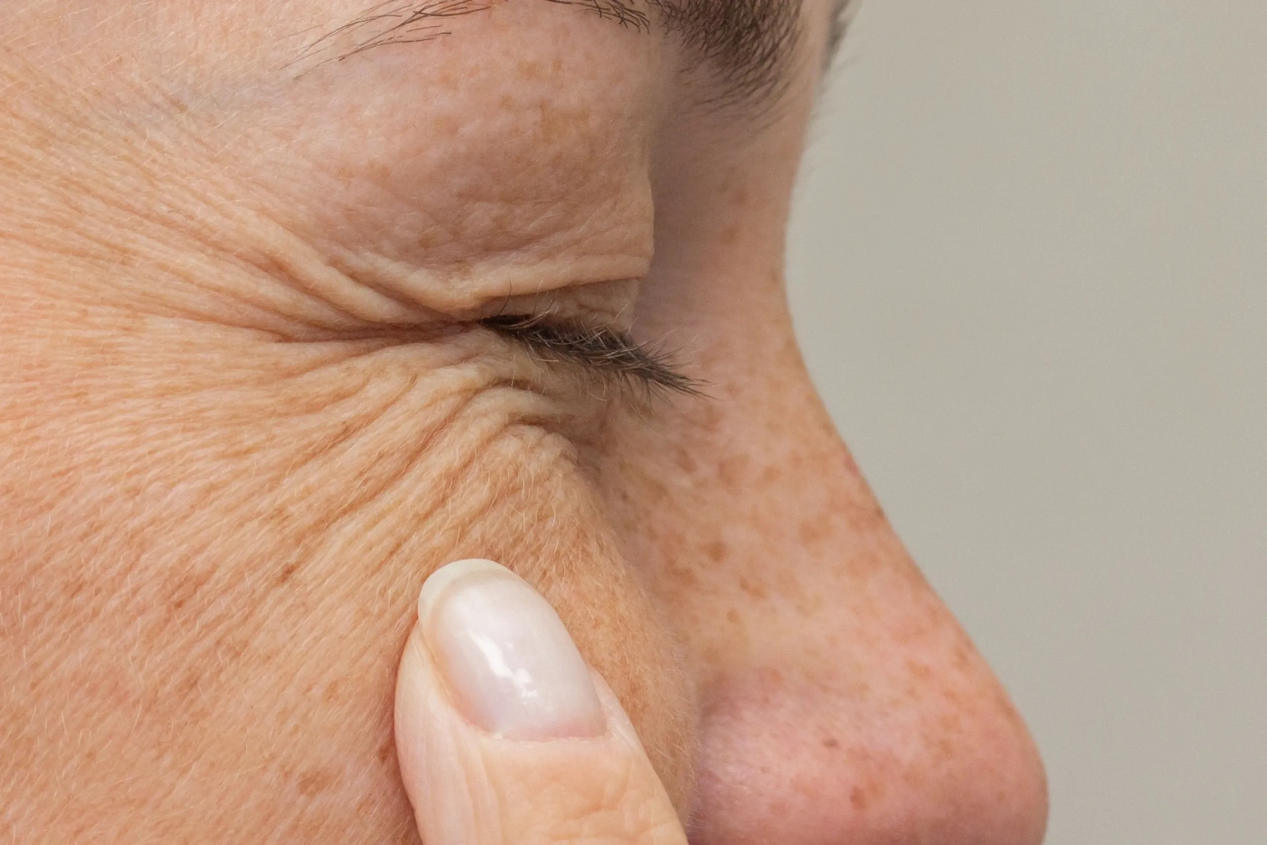 Lifestyle factors contributing to wrinkles and fine lines at Eternal Wellness Medical Spa Traverse City