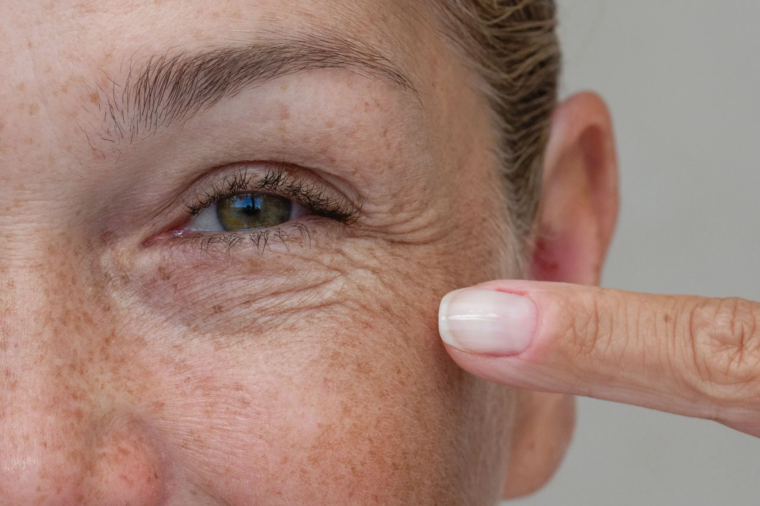 Woman examining fine lines near her eyes at Hartley Health and Wellness Canton
